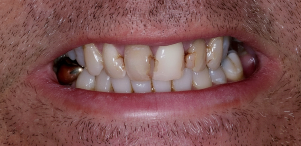 Before