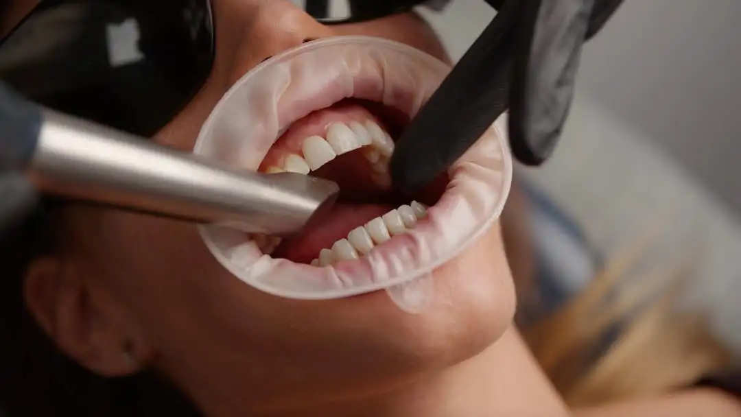 Teeth sculpting