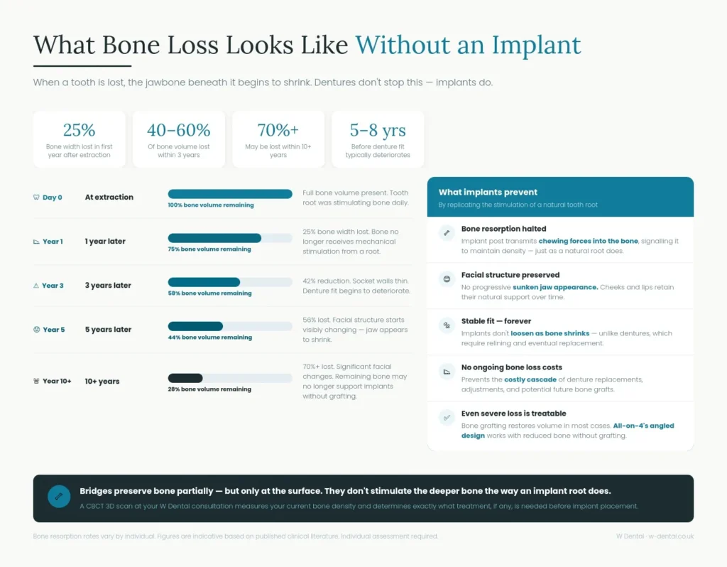 Percentages without a dental implant versus bridges