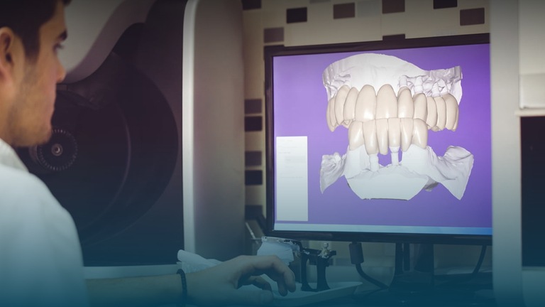 Dental Implant Procedure: A Step-by-Step Patient Guide