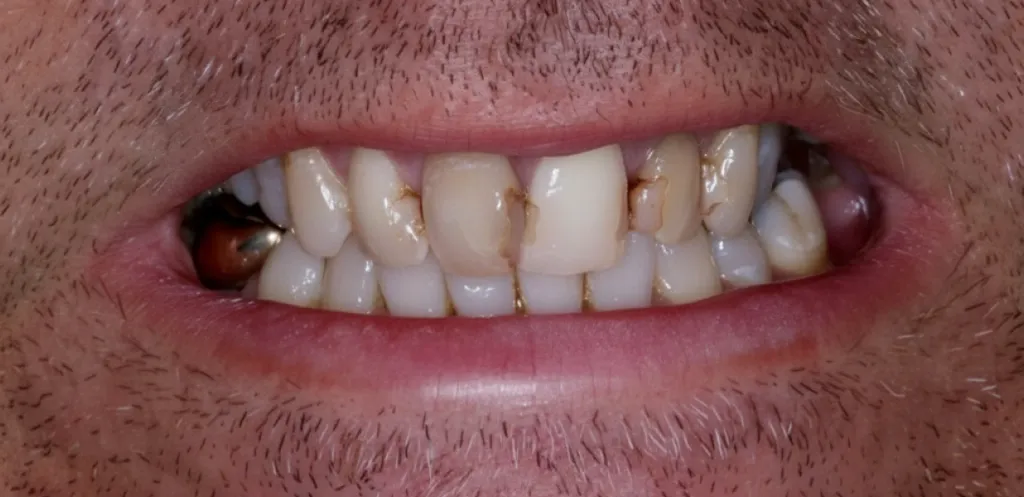 Before