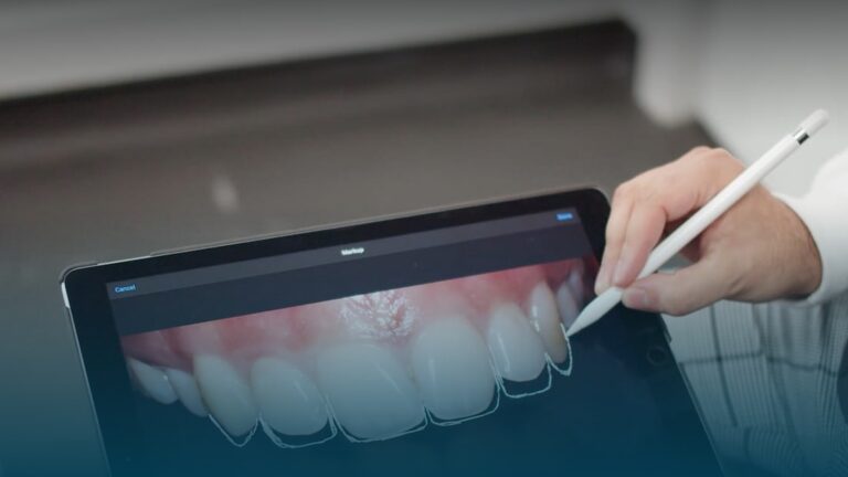 The Complete Guide to Composite Bonding in London