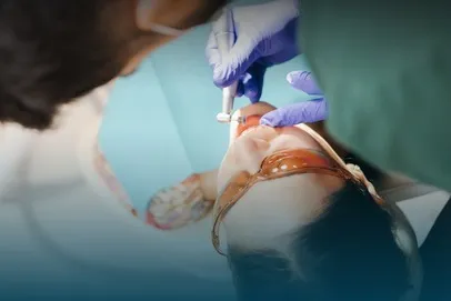 Dental Crowns in London: A Complete Guide