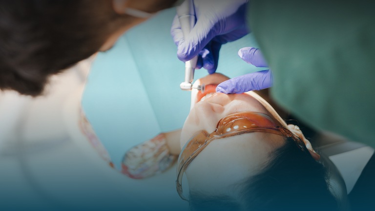 Dental Crowns in London: A Complete Guide