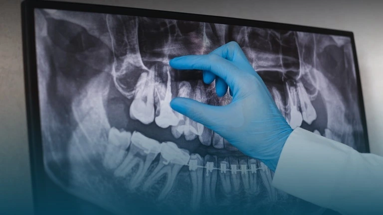 What is General Dentistry? Everything You Need to Know
