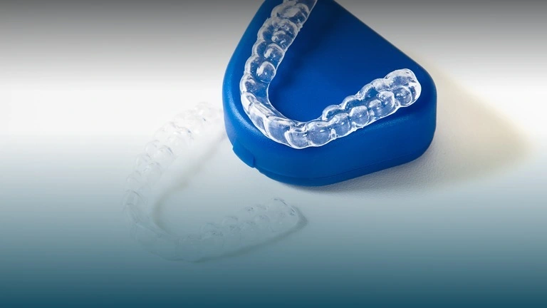 The Complete Guide to Dental Retainers