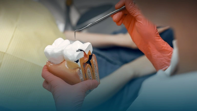 The Complete Guide to Root Canal Treatment in the UK