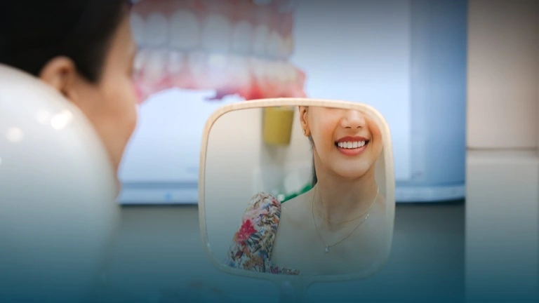 Everything You Need to Know About a Smile Makeover in London